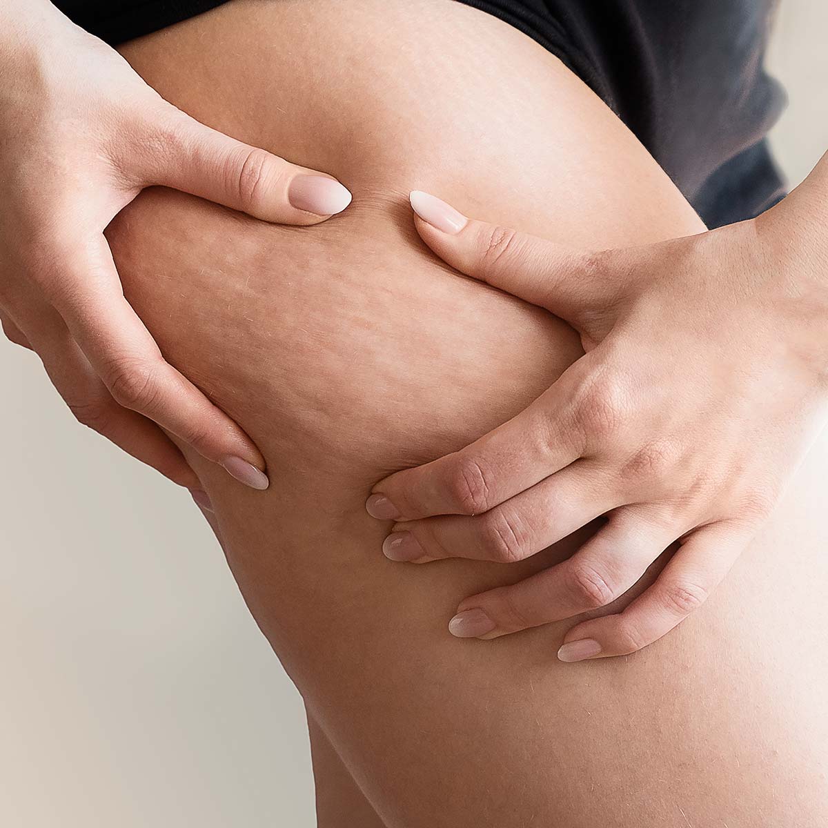 Lymphdrainage gegen Cellulite